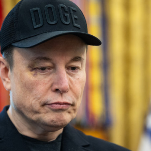 Elon Musk își explică vânătăia de pe față după o joacă cu fiul său