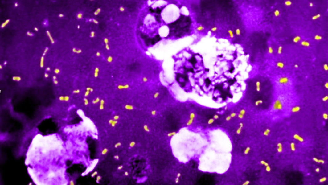 Descoperire surprinzătoare despre bacteria care a devastat lumea de mai multe ori